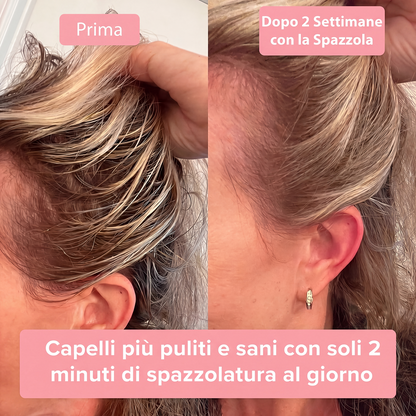 Spazzola Anti-Caduta per Capelli