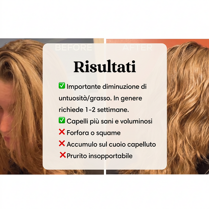 Spazzola Anti-Caduta per Capelli
